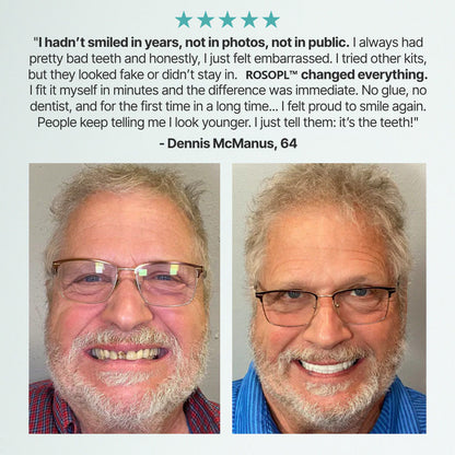 🌎 ROSOPLTM Custom-Fit Dentures ⏰ ENDS TODAY • 70% OFF | Smile with Confidence