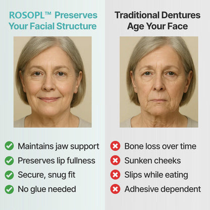 🌎 ROSOPLTM Custom-Fit Dentures ⏰ ENDS TODAY • 70% OFF | Smile with Confidence