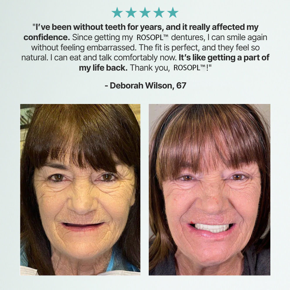 🌎 ROSOPLTM Custom-Fit Dentures ⏰ ENDS TODAY • 70% OFF | Smile with Confidence